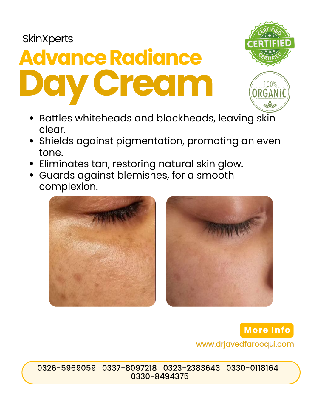 Bride Glow Box – Normal Skin