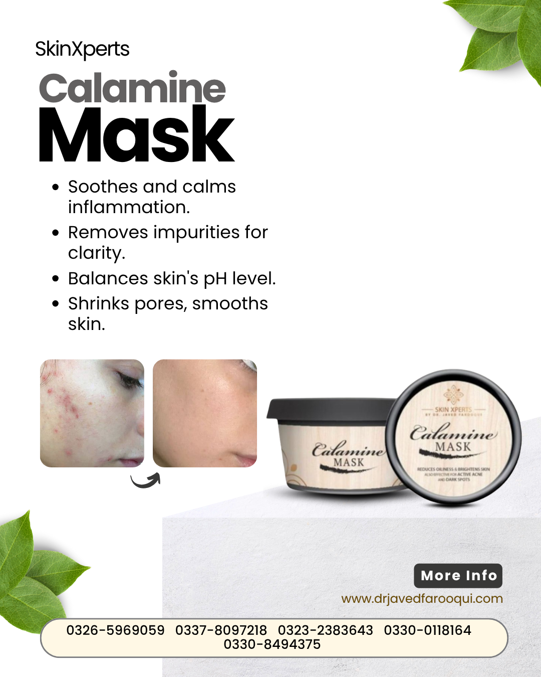 Bride Radiance Box – Pimple Care