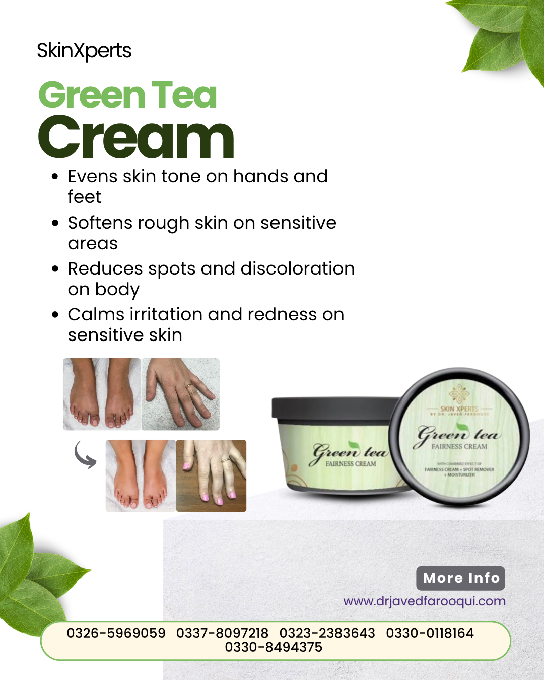 Bride Radiance Box – Pimple Care