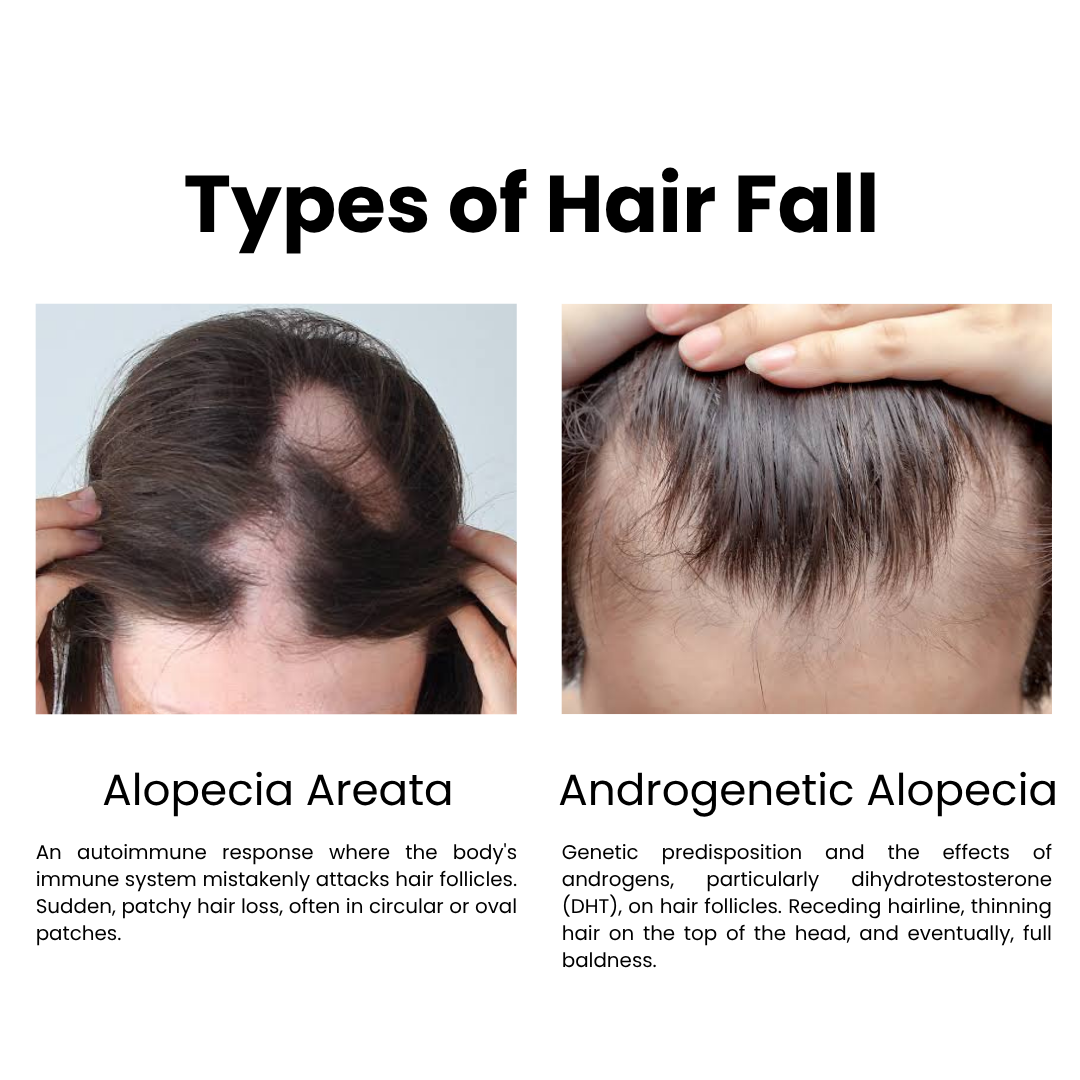 Hair Fall