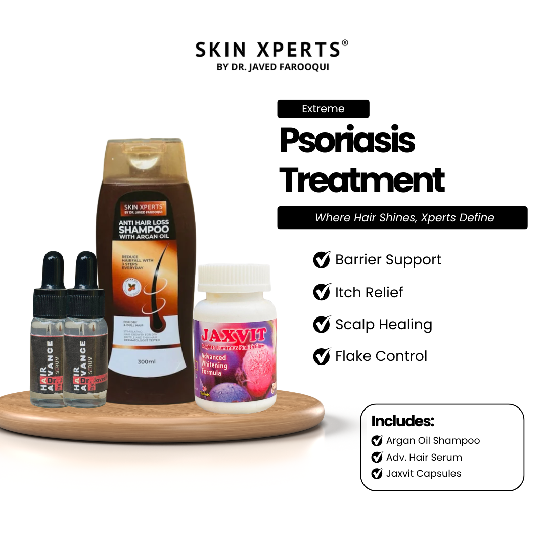 Psoriasis Treatment - Extreme